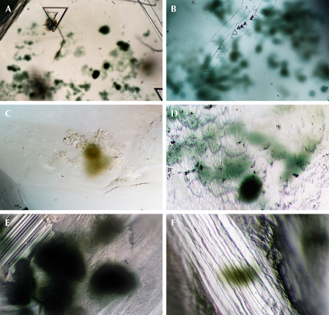 Figure 4. Radiation stains on surfaces of rough diamonds from Guyana, displaying variability in shape, hue, size, and opacity. Photomicrographs by Taryn Linzmeyer; fields of view 1.44 mm (A), 0.72 mm (B), and 0.288 mm (C–F).