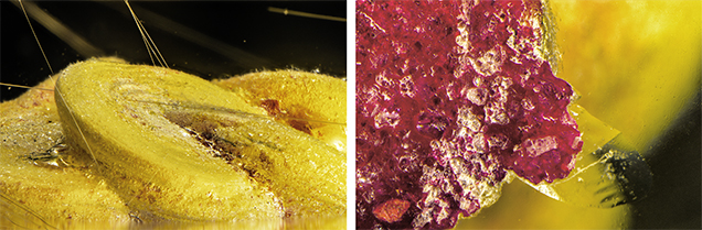 This creatively carved cavity was filled with a yellow and red composite material.