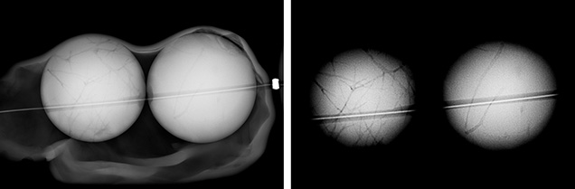 Microradiographs revealed two round bead nuclei (left) and a network of tubules (right). Images by Sharon Tsz Huen Wu. Microradiographs revealed two round bead nuclei (left) and a network of tubules (right). Images by Sharon Tsz Huen Wu.