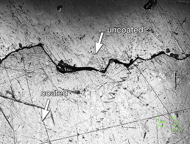 Figure 6. Laser scanning confocal microscopy showed that the loosely adhered coating had a thickness of nearly 16 μm thick. Photomicrograph by Jian Zhang; magnified 240×. Figure 6. Laser scanning confocal microscopy showed that the loosely adhered coating had a thickness of nearly 16 μm thick. Photomicrograph by Jian Zhang; magnified 240×.