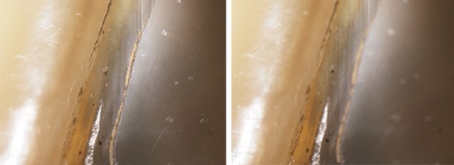 Pearl assembly deterioration