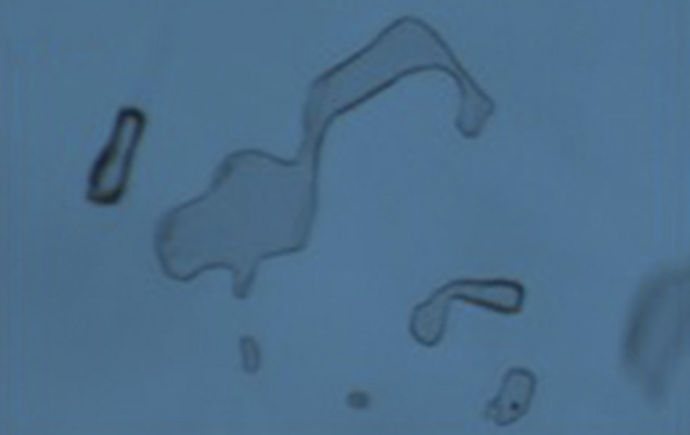 HOC synthetic alexandrite inclusion. HOC synthetic alexandrite inclusion.