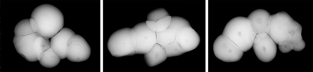 Microradiograph images of pearl Microradiograph images of pearl