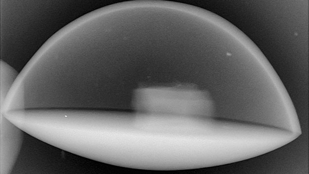 The microradiograph revealed an internal component. The microradiograph revealed an internal component.