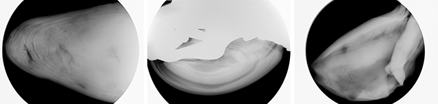Concentric and void-related internal structures typical of abalone pearls.