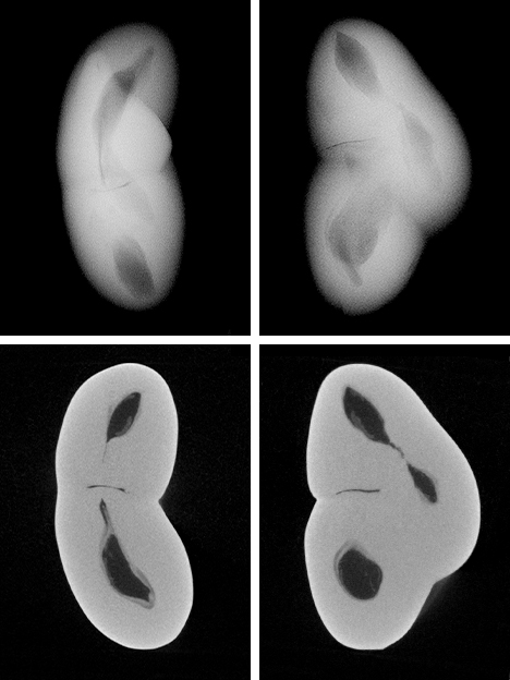 RTX and μ-CT images of non-bead-cultured pearl. Figure 12. RTX (top row) and μ-CT (bottom row) images of non-bead-cultured pearl sample no. 0668688502 in two orientations. The RTX images show the whole thickness of the pearl in each orientation, while each μ-CT image shows a micron-thin slice of the structure in each of the directions. The thickest orientation was not reproduced here, as the overlapping void features do not provide much insight when examining such multi-structured pearls.