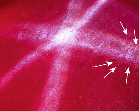 Asterism and Plato striations seen on the synthetic ruby’s surface. Asterism and Plato striations seen on the synthetic ruby’s surface.