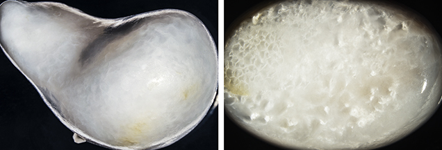 Mosaic pattern on the pearl and on a LaPearlite cabochon. Mosaic pattern on the pearl and on a LaPearlite cabochon.