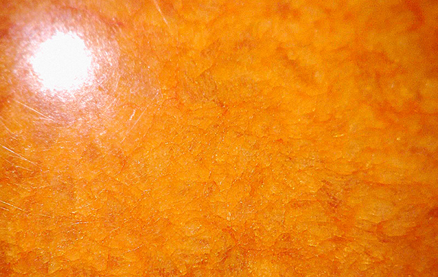 Figure 2. The 140.58 ct sphere exhibited a mosaic structure, and orange color concentration was noted within areas under magnification. Photomicrograph by Cheryl (Ying Wai) Au; field of view 6.92 mm. Figure 2. The 140.58 ct sphere exhibited a mosaic structure, and orange color concentration was noted within areas under magnification. Photomicrograph by Cheryl (Ying Wai) Au; field of view 6.92 mm.