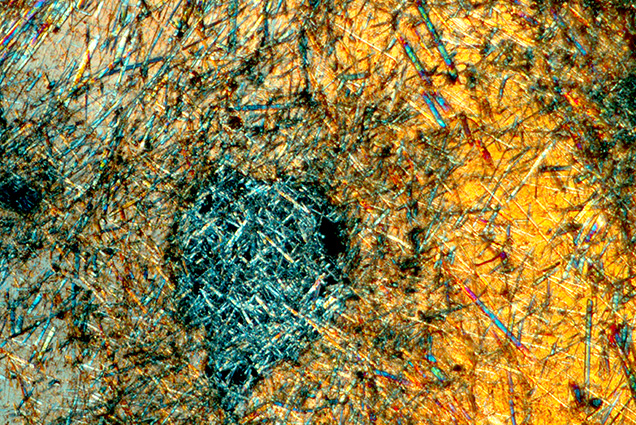 Figure 2. Under cross-polarized light, numerous prismatic inclusions are distributed within the 4.85 ct sphere. Photomicrograph by Rong Liang; field of view 2.15 mm. Figure 2. Under cross-polarized light, numerous prismatic inclusions are distributed within the 4.85 ct sphere. Photomicrograph by Rong Liang; field of view 2.15 mm.