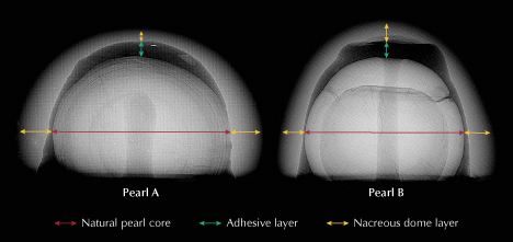Figure 3. RTX imaging of both pearls revealing natural pearl cores (indicated by red arrows), void formations along with the radiolucent adhesive material (green arrows), and button-shaped nacreous domes (yellow arrows). Figure 3. RTX imaging of both pearls revealing natural pearl cores (indicated by red arrows), void formations along with the radiolucent adhesive material (green arrows), and button-shaped nacreous domes (yellow arrows).