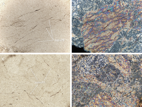 Four panels showing microscopic images with labeled features: "IntraPF" and "InterPF" in various textures and colors. Four panels showing microscopic images with labeled features: "IntraPF" and "InterPF" in various textures and colors.