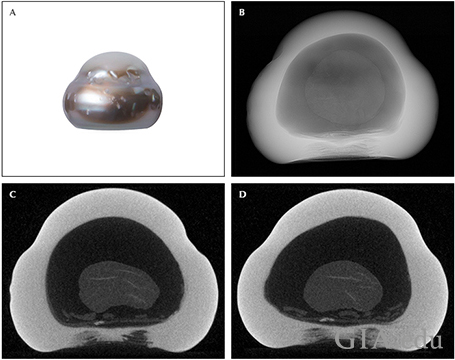 Fig15_468px_cc_w.png