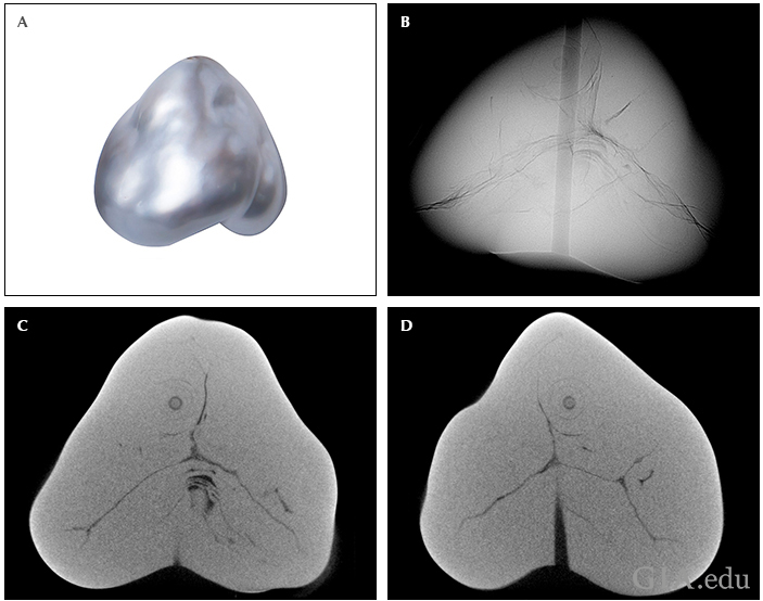 Fig25_720px_cc_w.png