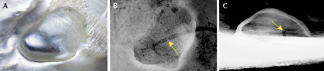 Partially merging outline typical of shell blisters. Partially merging outline typical of shell blisters.
