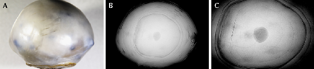 Microradiographs reveal pearl’s natural internal structure. Microradiographs reveal pearl’s natural internal structure.