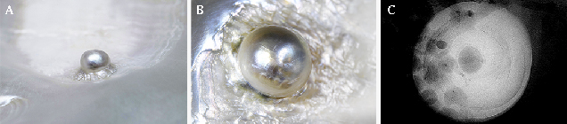 Figure 9. A: Photo of natural blister pearl (B-7) showing a near-round pearl affixed to its host’s shell with uneven nacre layers around it. Photo by Lhapsin Nillapat. B: Photomicrograph showing the rippled nacreous layers securing the pearl to the shell. Photo by Kwanreun Lawanwong; field of view 14.40 mm. C: Microradiograph revealing an internal scene comprised of a small dark organic-rich core surrounded by concentric growth arcs, typical of many natural pearls. Figure 9. A: Photo of natural blister pearl (B-7) showing a near-round pearl affixed to its host’s shell with uneven nacre layers around it. Photo by Lhapsin Nillapat. B: Photomicrograph showing the rippled nacreous layers securing the pearl to the shell. Photo by Kwanreun Lawanwong; field of view 14.40 mm. C: Microradiograph revealing an internal scene comprised of a small dark organic-rich core surrounded by concentric growth arcs, typical of many natural pearls.