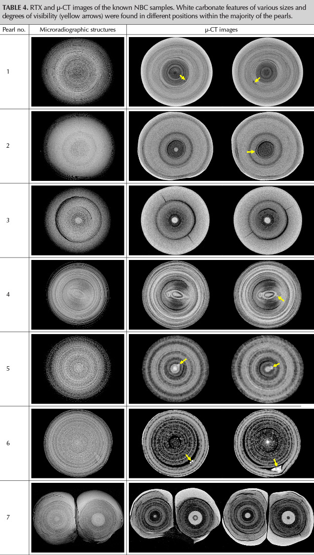 RTX and μ-CT images of the known NBC samples. White carbonate features of various sizes and degrees of visibility (yellow arrows) were found in different positions within the majority of the pearls. RTX and μ-CT images of the known NBC samples. White carbonate features of various sizes and degrees of visibility (yellow arrows) were found in different positions within the majority of the pearls.