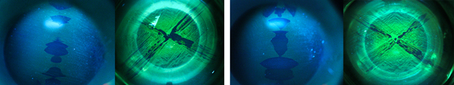 Ultra-short-wave illumination reveals the location of asterism. Ultra-short-wave illumination reveals the location of asterism.