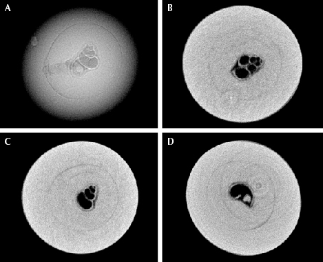 Figure 2. The gastropod shell, measuring approximately 0.50 × 0.30 mm, observed in pearl A. A: RTX image of the shell. B–D: μ-CT scans of the shell in the X, Y, and Z directions, respectively. (The weak white rings on the lower right image are artifacts and not pearl-related structures.)