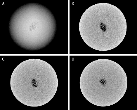 Figure 3. The foraminifera test, measuring approximately 0.45 × 0.35 mm, observed in pearl B. A: RTX image of the foraminifera test. B–D: μ-CT scans of the foraminifera test in the X, Y, and Z directions, respectively. (Again, the weak white rings on the lower right image are artifacts.)