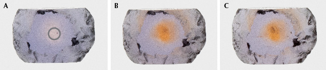 Figure 52. The Rock Creek sapphire in example 5, measuring 0.8 × 0.5 mm: unheated (A), heated to 1200°C in pure O2 (B), and heated to 1700°C in pure O2 (C). The gray circle shows area of analysis. Photos by Aaron Palke.