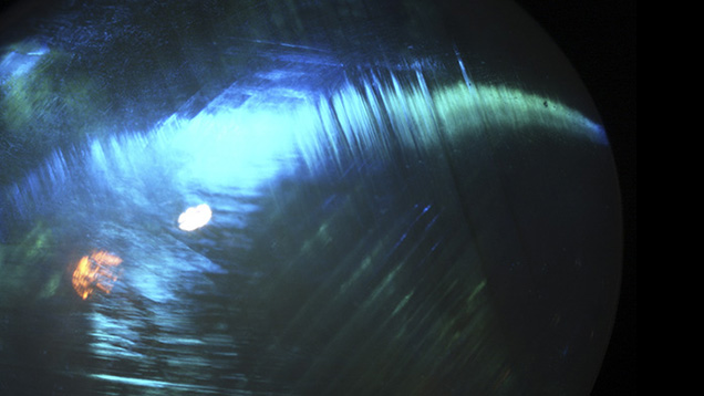 Photomicrograph of star opal