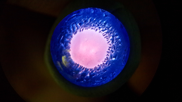 Eye-like pattern under fiber-optic light.