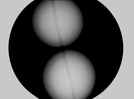 X-ray of Chinese bead-cultured pearl X-ray of Chinese bead-cultured pearl