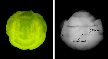 Figure 4. X-ray fluorescence reaction (left) and an RTX image showing the Lord Ganesha pearl’s internal structure (right). A small twisted void and discoid features can be seen in the center. Figure 4. X-ray fluorescence reaction (left) and an RTX image showing the Lord Ganesha pearl’s internal structure (right). A small twisted void and discoid features can be seen in the center.