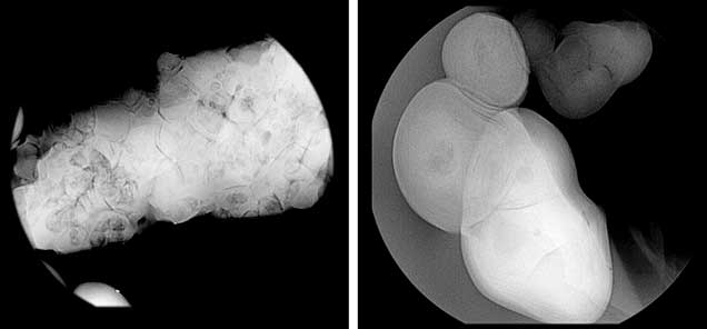 Blister pearl consisting of smaller seed pearls. Blister pearl consisting of smaller seed pearls.