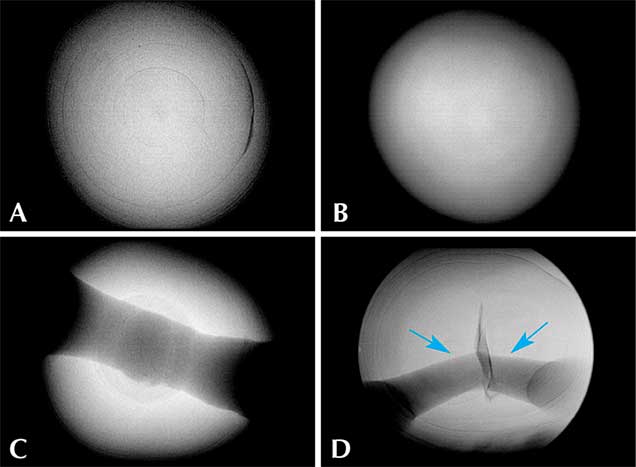 Internal growth structures of pearls studied by GIA. Internal growth structures of pearls studied by GIA.