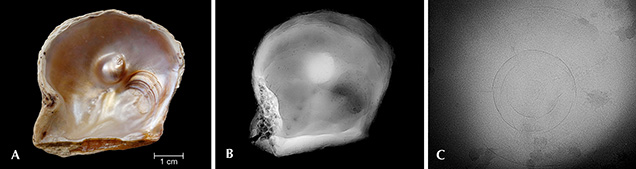 Analysis of a blister pearl Analysis of a blister pearl