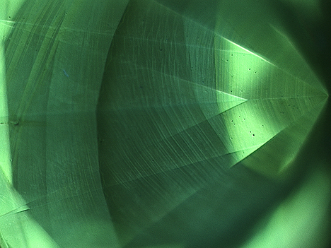 Striations are diagnostic of a CVD origin.