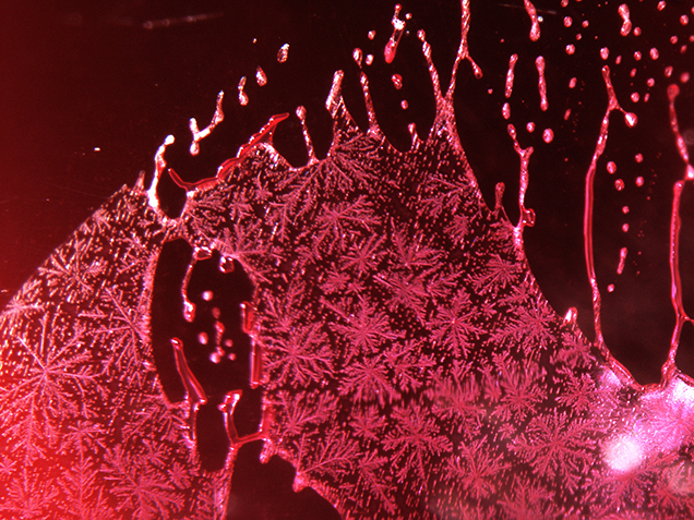 Snowflake-like pattern seen in a partially healed fissure. Snowflake-like pattern seen in a partially healed fissure.