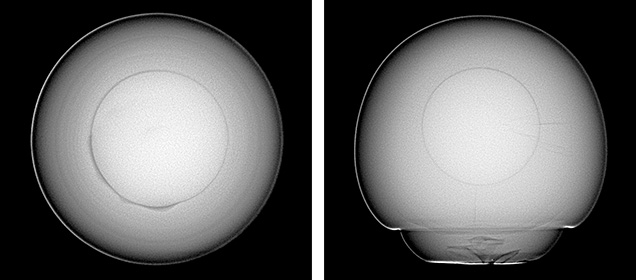 Figure 4. RTX imaging revealed a round bead nucleus in the center of each pearl, indicating the pearls were bead cultured. Images by Stephanie Shaw.