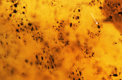 Figure 2. Microscopic examination under high magnification revealed the hexagonal shape of the black inclusions. Photomicrograph by Mei Yan Lai; field of view 1.26 mm. Figure 2. Microscopic examination under high magnification revealed the hexagonal shape of the black inclusions. Photomicrograph by Mei Yan Lai; field of view 1.26 mm.