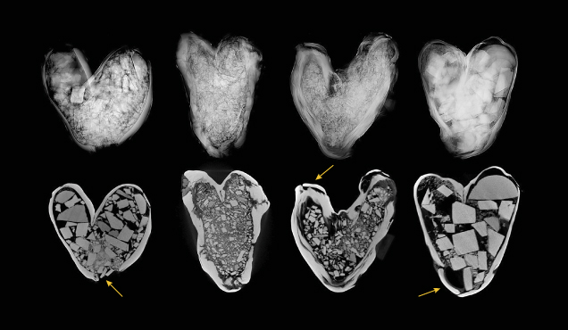 Figure 3. Top: RTX images showing the complex internal structure of the four natural hollow pearls filled with unidentified foreign material. Bottom: μ-CT images showing the detailed outline of rectangular and tabular cut fragments used as filler and the pearl openings plugged with shell (indicated with arrows). Figure 3. Top: RTX images showing the complex internal structure of the four natural hollow pearls filled with unidentified foreign material. Bottom: μ-CT images showing the detailed outline of rectangular and tabular cut fragments used as filler and the pearl openings plugged with shell (indicated with arrows).