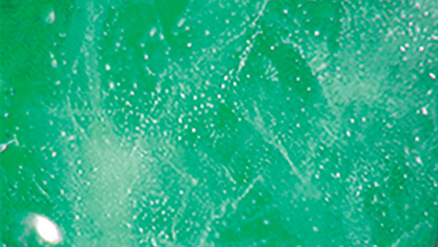 Fingerprint-like patterns in beryl and topaz doublet