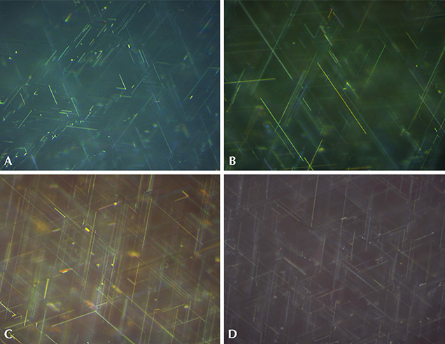 Rutile needles in Wiede’s synthetic star corundum Rutile needles in Wiede’s synthetic star corundum