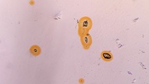 Figure 1. A view through the girdle displayed one of the lighter violet pleochroic colors of the iolite host, revealing a mix of monazite and zircon inclusions surrounded by yellow radiation halos. Note the colorless cores in the larger halos. Photomicrograph by Emily Jones; field of view 3.64 mm. Figure 1. A view through the girdle displayed one of the lighter violet pleochroic colors of the iolite host, revealing a mix of monazite and zircon inclusions surrounded by yellow radiation halos. Note the colorless cores in the larger halos. Photomicrograph by Emily Jones; field of view 3.64 mm.