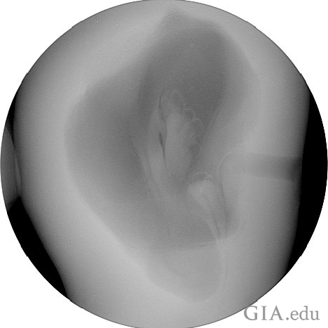 Figure 8: Microradiograph of the 18.65 ct pearl in the 1st orientation
