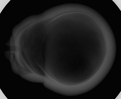 Figure 6: Microradiograph taken in the second direction (90° to 1st direction).