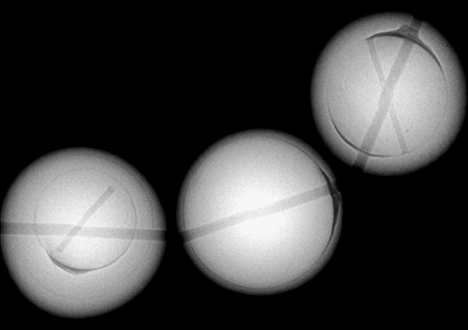 X-ray images of dyed freshwater cultured pearls. X-ray images of dyed freshwater cultured pearls.