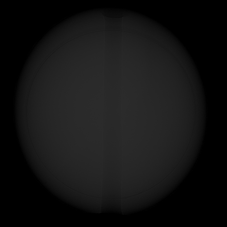 Microradiographs produced with an FPD and an II