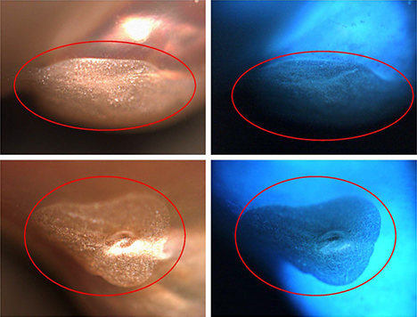Filled portions of pearl in visible light (left) and DiamondView (right). Filled portions of pearl in visible light (left) and DiamondView (right).