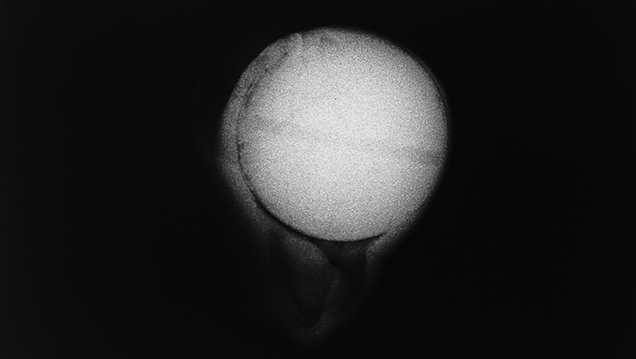 : X-radiography proved this was a bead-cultured pearl. : X-radiography proved this was a bead-cultured pearl.