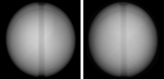 Microradiographs produced with an FPD (left) and an II (right) Microradiographs produced with an FPD (left) and an II (right)