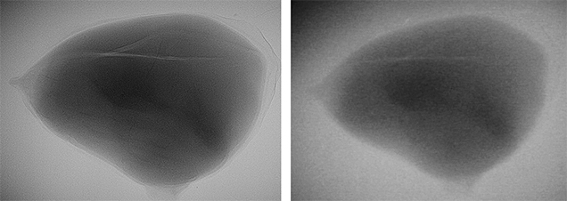 Figure 4. Microradiographs of the center of sample 19 (a non-bead-cultured saltwater pearl from Pinctada maxima), produced with an FPD (left) and an II (right); fields of view approximately 7 mm. Figure 4. Microradiographs of the center of sample 19 (a non-bead-cultured saltwater pearl from Pinctada maxima), produced with an FPD (left) and an II (right); fields of view approximately 7 mm.